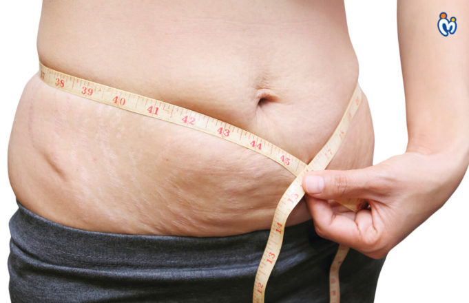 How to Lose Post Pregnancy Weight? 3 Effective Ways How to Lose Post Pregnancy Weight? 3 Effective Ways